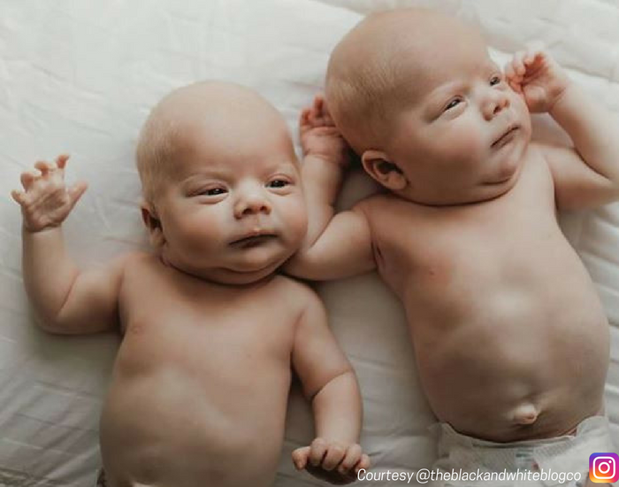 ДНК- тестирование близнецов: Идентичные или «Двойняшки»?