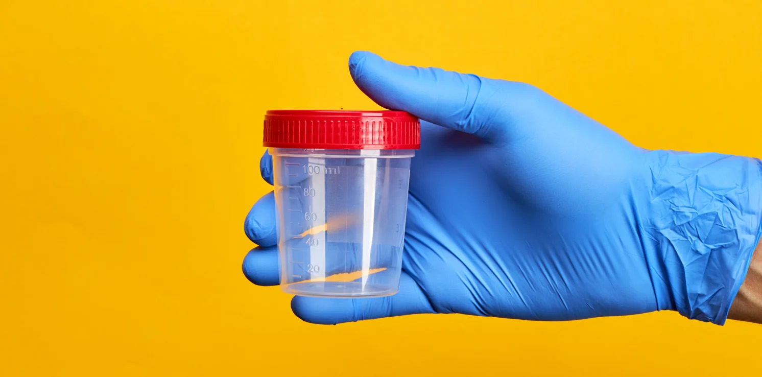 Urine Test Cup DNA Test Blue Doctor Gloves