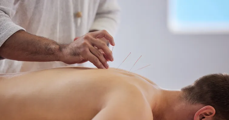 acupuncture and fertility