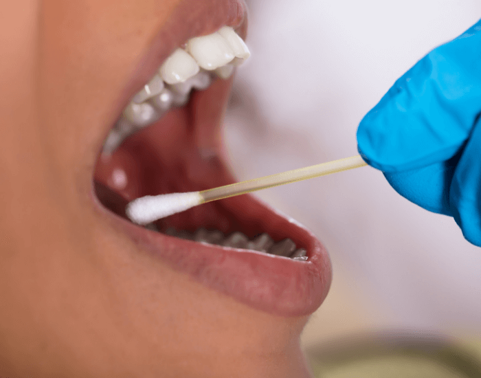 swabs vs blood samples dna testing